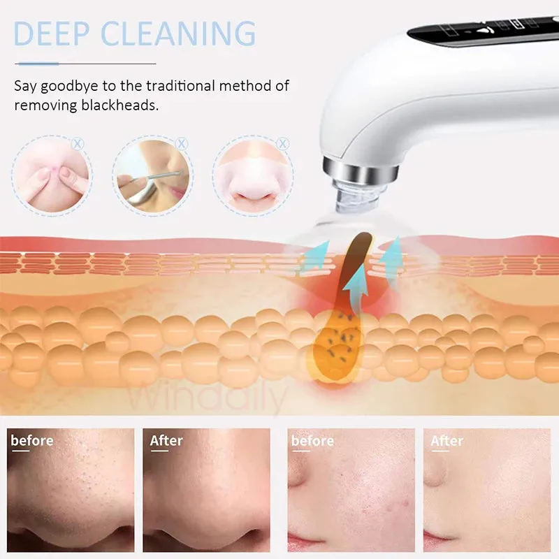 2023 Blackhead Remover Pore Vacuum Cleaner Electric Micro Small Bubble Facial Cleasing Machine USB Rechargeable Beauty Device